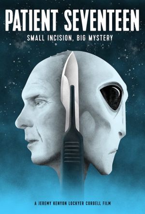 Пациент номер семнадцать